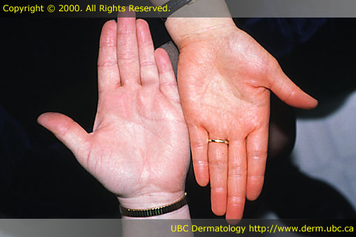 dermatologic photos