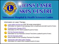 laser info