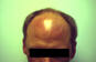Click to Zoom 2:1