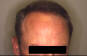 Click to Zoom 2:1