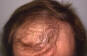 Click to Zoom 2:1