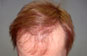 Click to Zoom 2:1