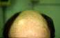 Click to Zoom 2:1
