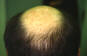 Click to Zoom 2:1