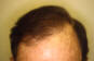 Click to Zoom 2:1