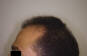 Click to Zoom 2:1
