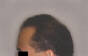 Click to Zoom 2:1