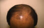 Click to Zoom 2:1