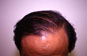 Click to Zoom 2:1