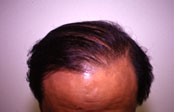 Click to Zoom 3:1