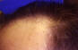 Click to Zoom 2:1