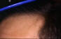 Click to Zoom 2:1