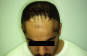 Click to Zoom 2:1