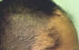 Click to Zoom 2:1