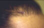 Click to Zoom 2:1