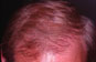 Click to Zoom 2:1