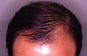 Click to Zoom 2:1