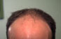 Click to Zoom 2:1