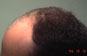 Click to Zoom 2:1