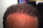 Click to Zoom 2:1