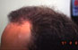 Click to Zoom 2:1