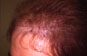 Click to Zoom 2:1
