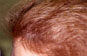 Click to Zoom 2:1