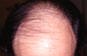 Click to Zoom 2:1