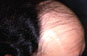 Click to Zoom 2:1