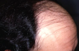 Click to Zoom 2:1