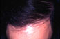 Click to Zoom 2:1