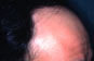 Click to Zoom 2:1