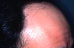 Click to Zoom 2:1