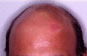 Click to Zoom 2:1