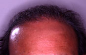 Click to Zoom 3:1