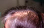 Click to Zoom 2:1
