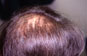 Click to Zoom 2:1