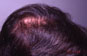 Click to Zoom 2:1