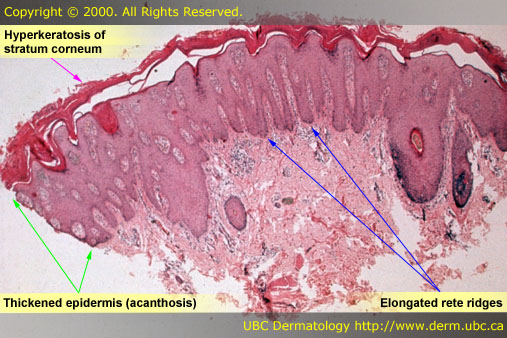 psor32b.jpg (80788 bytes)