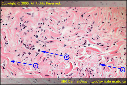 Dermatological Disorders Resource Center - MPR