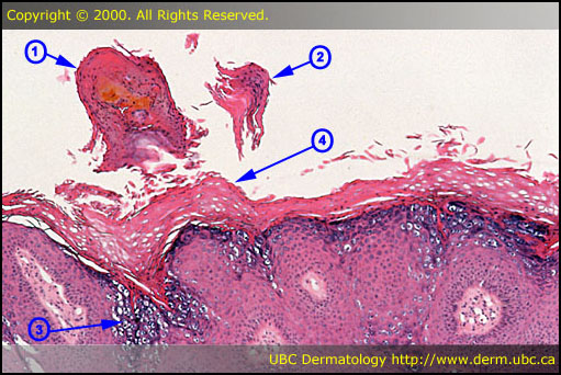 Search › dermatologic pathology | Quizlet