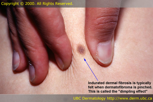 derma pathology