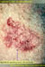 Superficial Spreading Basal Cell Carcinoma