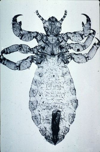 Pediculus corporis